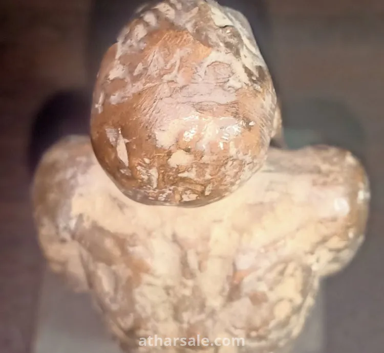 تمثال طبي نادر – إعلان عن علاج الربو ببخاخ فنتولين وبيكوتايد – قطعة فريدة لهواة التحف الطبية